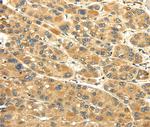 UACA Antibody in Immunohistochemistry (Paraffin) (IHC (P))