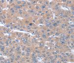 SULF1 Antibody in Immunohistochemistry (Paraffin) (IHC (P))