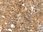 SMYD4 Antibody in Immunohistochemistry (Paraffin) (IHC (P))