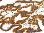 SMYD4 Antibody in Immunohistochemistry (Paraffin) (IHC (P))