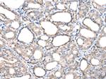 TIM17 Antibody in Immunohistochemistry (Paraffin) (IHC (P))