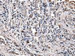 CHMP3 Antibody in Immunohistochemistry (Paraffin) (IHC (P))