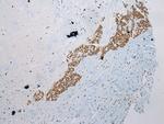 WDR45 Antibody in Immunohistochemistry (Paraffin) (IHC (P))