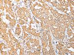 NDUFB10 Antibody in Immunohistochemistry (Paraffin) (IHC (P))