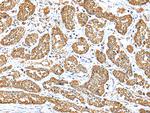 NDUFB10 Antibody in Immunohistochemistry (Paraffin) (IHC (P))