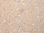 RFK Antibody in Immunohistochemistry (Paraffin) (IHC (P))