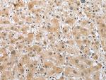 RFK Antibody in Immunohistochemistry (Paraffin) (IHC (P))