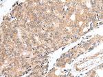 PRELID1 Antibody in Immunohistochemistry (Paraffin) (IHC (P))