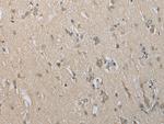 DECR2 Antibody in Immunohistochemistry (Paraffin) (IHC (P))