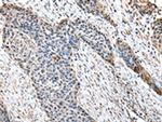 HPD Antibody in Immunohistochemistry (Paraffin) (IHC (P))