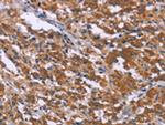 SKI Antibody in Immunohistochemistry (Paraffin) (IHC (P))