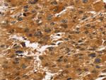 TACC2 Antibody in Immunohistochemistry (Paraffin) (IHC (P))