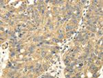 UHRF1BP1 Antibody in Immunohistochemistry (Paraffin) (IHC (P))