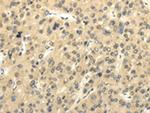 UHRF1BP1 Antibody in Immunohistochemistry (Paraffin) (IHC (P))