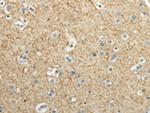 WNT2 Antibody in Immunohistochemistry (Paraffin) (IHC (P))