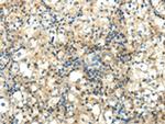 WNT2 Antibody in Immunohistochemistry (Paraffin) (IHC (P))