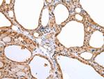 Aquaporin 9 Antibody in Immunohistochemistry (Paraffin) (IHC (P))