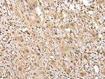 GSTM2 Antibody in Immunohistochemistry (Paraffin) (IHC (P))