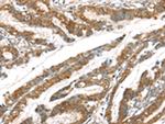 GPD2 Antibody in Immunohistochemistry (Paraffin) (IHC (P))