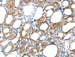 GPD2 Antibody in Immunohistochemistry (Paraffin) (IHC (P))