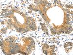 UBTD1 Antibody in Immunohistochemistry (Paraffin) (IHC (P))