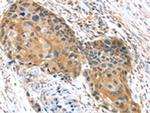 UBTD1 Antibody in Immunohistochemistry (Paraffin) (IHC (P))