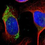 OTC Antibody in Immunocytochemistry (ICC/IF)