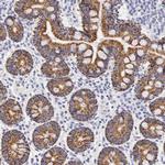 OTC Antibody in Immunohistochemistry (IHC)