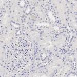 OTC Antibody in Immunohistochemistry (IHC)