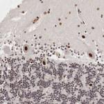 DACH2 Antibody in Immunohistochemistry (Paraffin) (IHC (P))