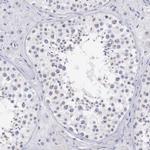 RFP2 Antibody in Immunohistochemistry (Paraffin) (IHC (P))