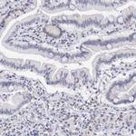 RFP2 Antibody in Immunohistochemistry (IHC)