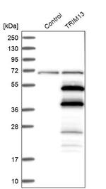 RFP2 Antibody in Western Blot (WB)