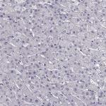 ZNF185 Antibody in Immunohistochemistry (IHC)