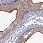 ZNF185 Antibody in Immunohistochemistry (IHC)