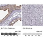 ZNF185 Antibody