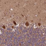 ARHGAP12 Antibody in Immunohistochemistry (Paraffin) (IHC (P))