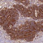 ARHGAP12 Antibody in Immunohistochemistry (Paraffin) (IHC (P))