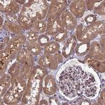 ARHGAP12 Antibody in Immunohistochemistry (Paraffin) (IHC (P))