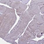 ARHGAP12 Antibody in Immunohistochemistry (Paraffin) (IHC (P))