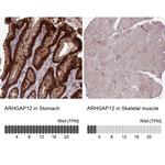 ARHGAP12 Antibody in Immunohistochemistry (IHC)