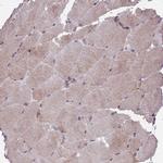 ARHGAP12 Antibody in Immunohistochemistry (IHC)