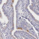 IDH3G Antibody in Immunohistochemistry (IHC)