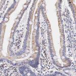 IDH3G Antibody in Immunohistochemistry (IHC)