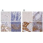 RENBP Antibody in Immunohistochemistry (IHC)