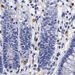 RENBP Antibody in Immunohistochemistry (IHC)