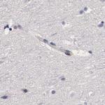 RENBP Antibody in Immunohistochemistry (IHC)