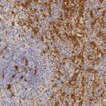 RENBP Antibody in Immunohistochemistry (IHC)