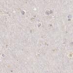 RENBP Antibody in Immunohistochemistry (IHC)