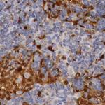 RENBP Antibody in Immunohistochemistry (IHC)